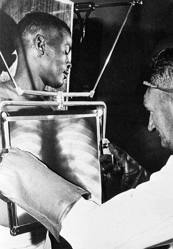 Рентгенолог проверяет желудок шахтера на наличие проглоченных алмазов, 1954 год, Кимберли, ЮАР