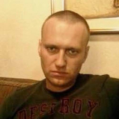 Алексей Навальный без волос