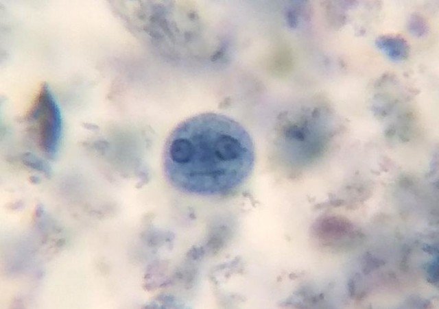 Амеба через микроскоп