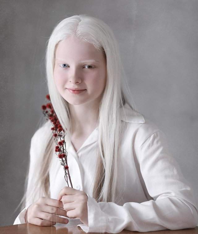 Амина Эпендиева - 11 летняя девочка из Чечни, которая поразила соцсети своей внешностью