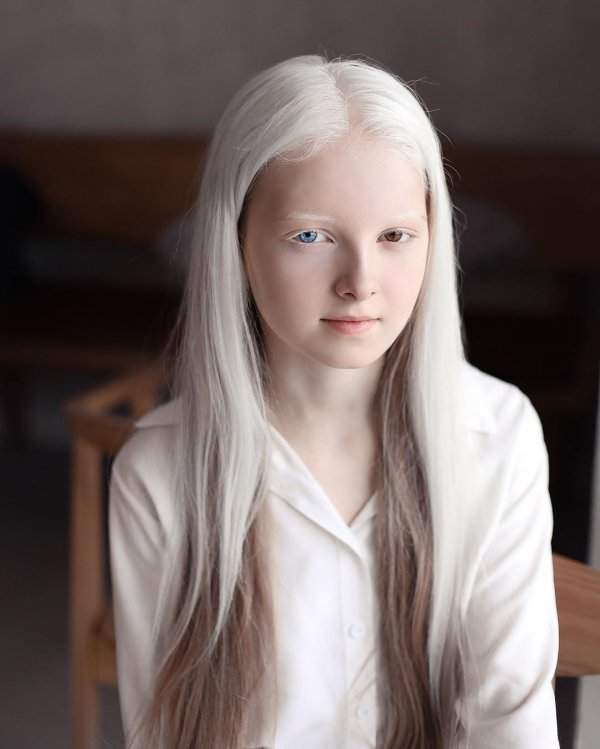 Амина Эпендиева - 11 летняя девочка из Чечни, которая поразила соцсети своей внешностью