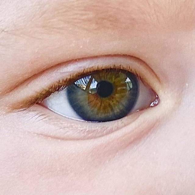 Необычные глаза девочки
