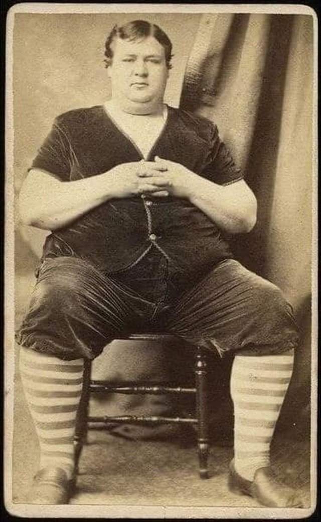 В начале прошлого века этого мужчину показывали в цирке, так как считали очень толстым. Начало 1900-х