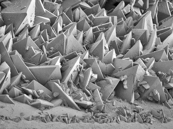 Камень в почке под микроскопом — теперь ясно, почему от них так больно