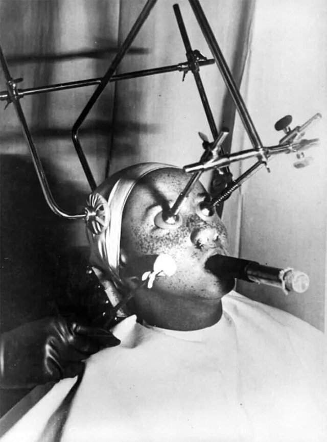 &quot;Уничтожитель&quot; веснушек. Во время эксперимента требовалось закрывать глаза специальными накладками, вставлять в ноздри фильтры и часами дышать только через специальную трубку. 1930-е годы