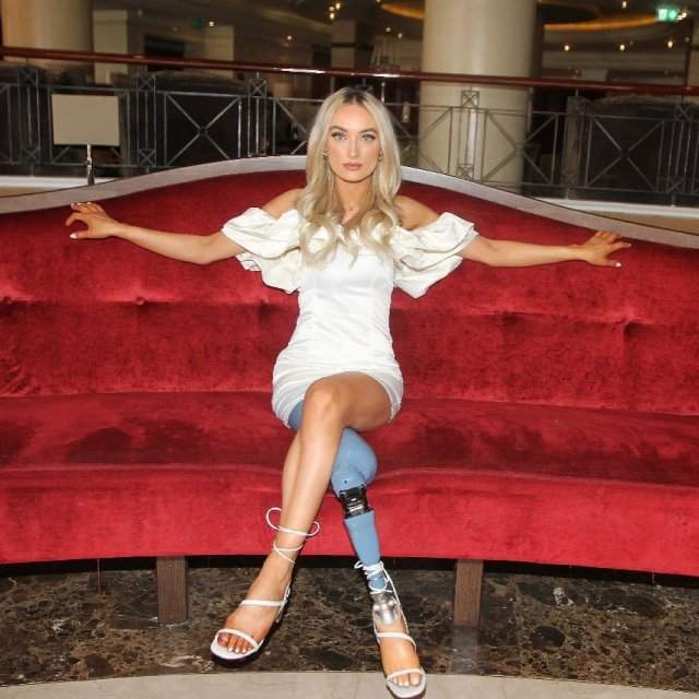 Бернадетт Хагенс - девушка без ноги, которая вышла в финал конкурса красоты Мисс Северная Ирландия сидит в белом платье на красном диване