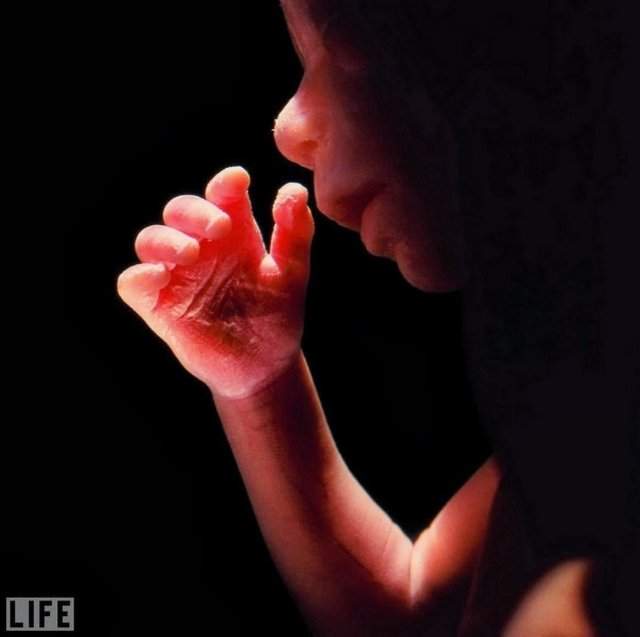 Пepвый в истории снимoк peбенка в утробе матери, 1965 год