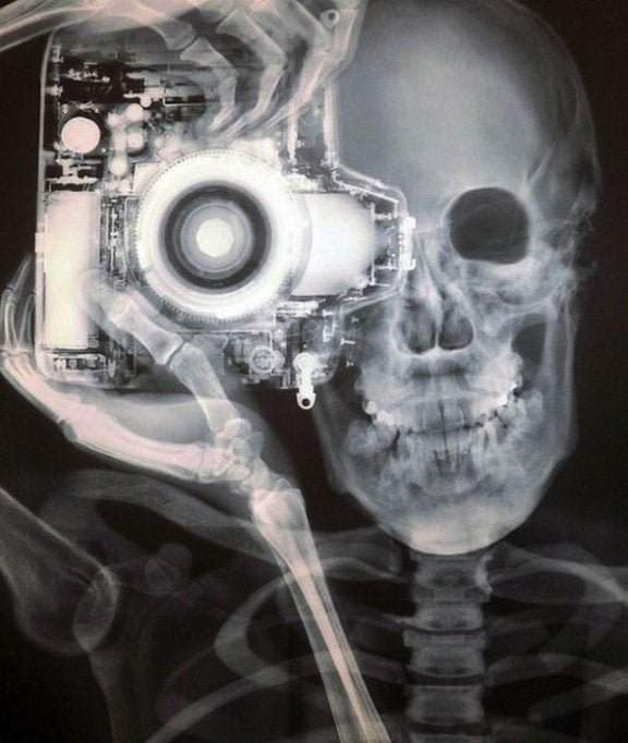 Рентген фотографирующего человека