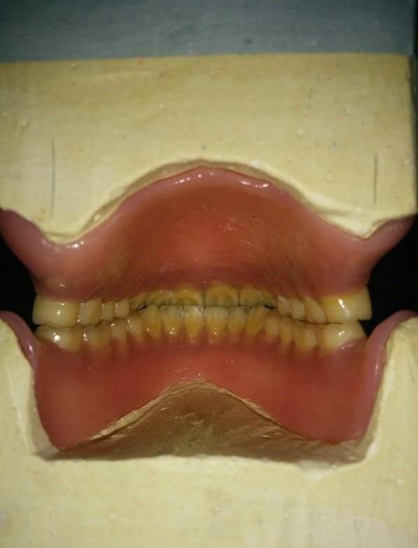 Зубной ряд изнутри