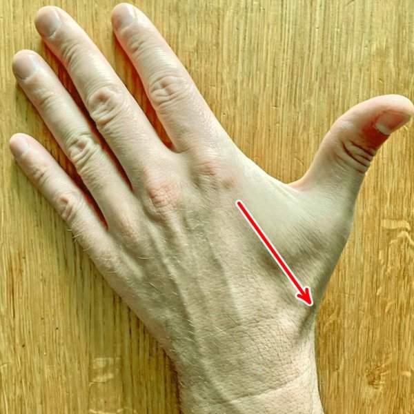 Треугольное углубление у основания большого пальца именуется анатомической табакеркой
