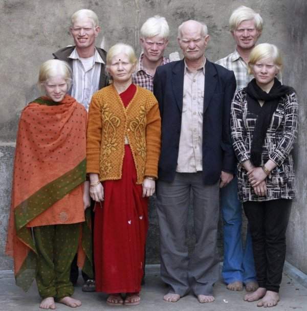 Семья Пуллан в Индии установила мировой рекорд по количеству альбиносов в одной семье
