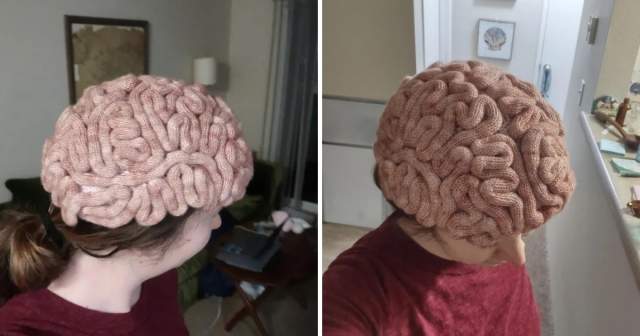 Мозговая шапка