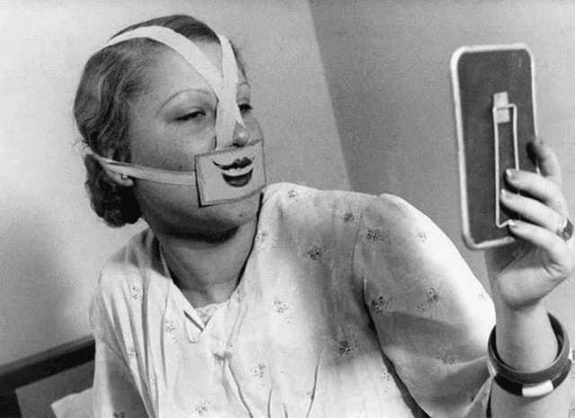 Женщина в специальной маске для борьбы с депрессией, 1937 год