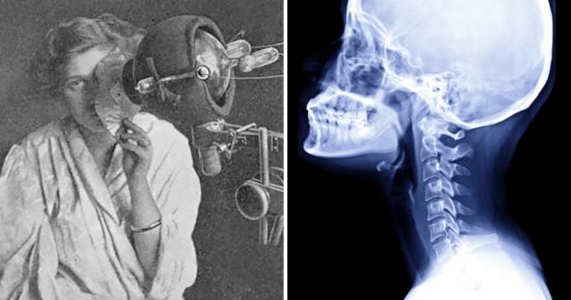 Рентгеновский аппарат для красоты