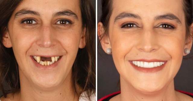 &quot;Сила красивой улыбки&quot;: работы португальского дантиста, который преображает своих пациентов