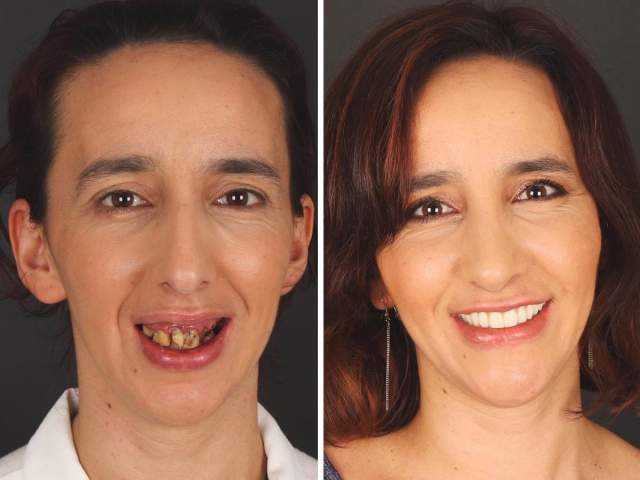 &quot;Сила красивой улыбки&quot;: работы португальского дантиста, который преображает своих пациентов
