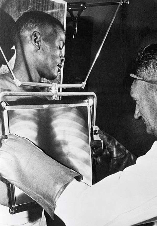 Рабочий алмазных шахт в конце каждой смены проходит проверку рентгеном перед тем как покинуть шахты. ЮАР, 1954 год.