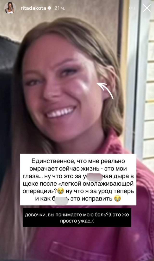Рита Дакота и страшные последствия пластической операции Рита Дакота и страшные последствия пластической операции