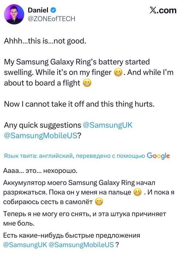 Мужчина чуть не потерял палец из-за умного кольца от Samsung
